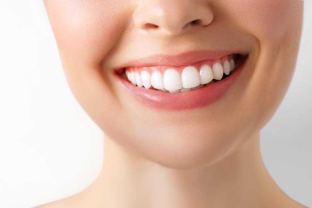 teeth whitening