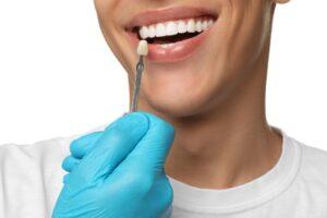 Porcelain Veneers: What They Are and How They Transform Your Smile