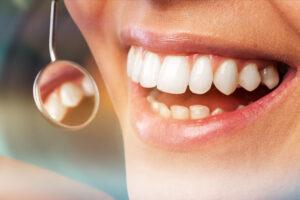 periodontal therapy