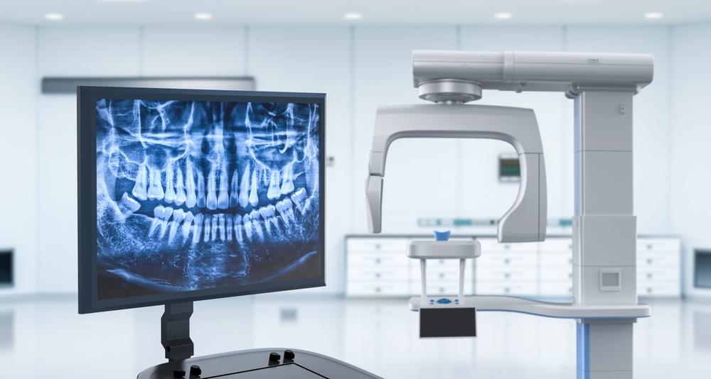 Early Cavity Detection with Digital X-Rays