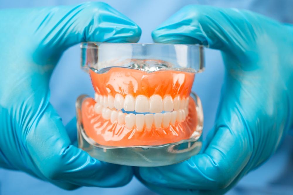 Dentures vs. Dental Implants: Which Is the Better Choice?