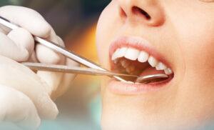 Periodontal Therapy for Gum Disease Relief